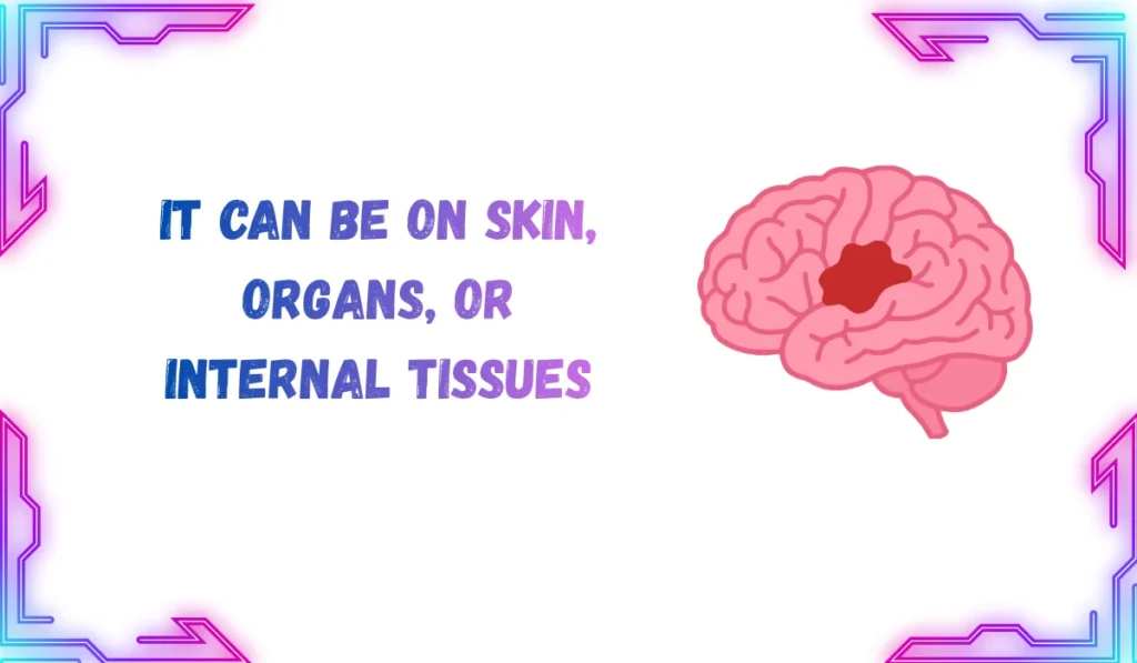 lesion meaning