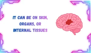 lesion meaning